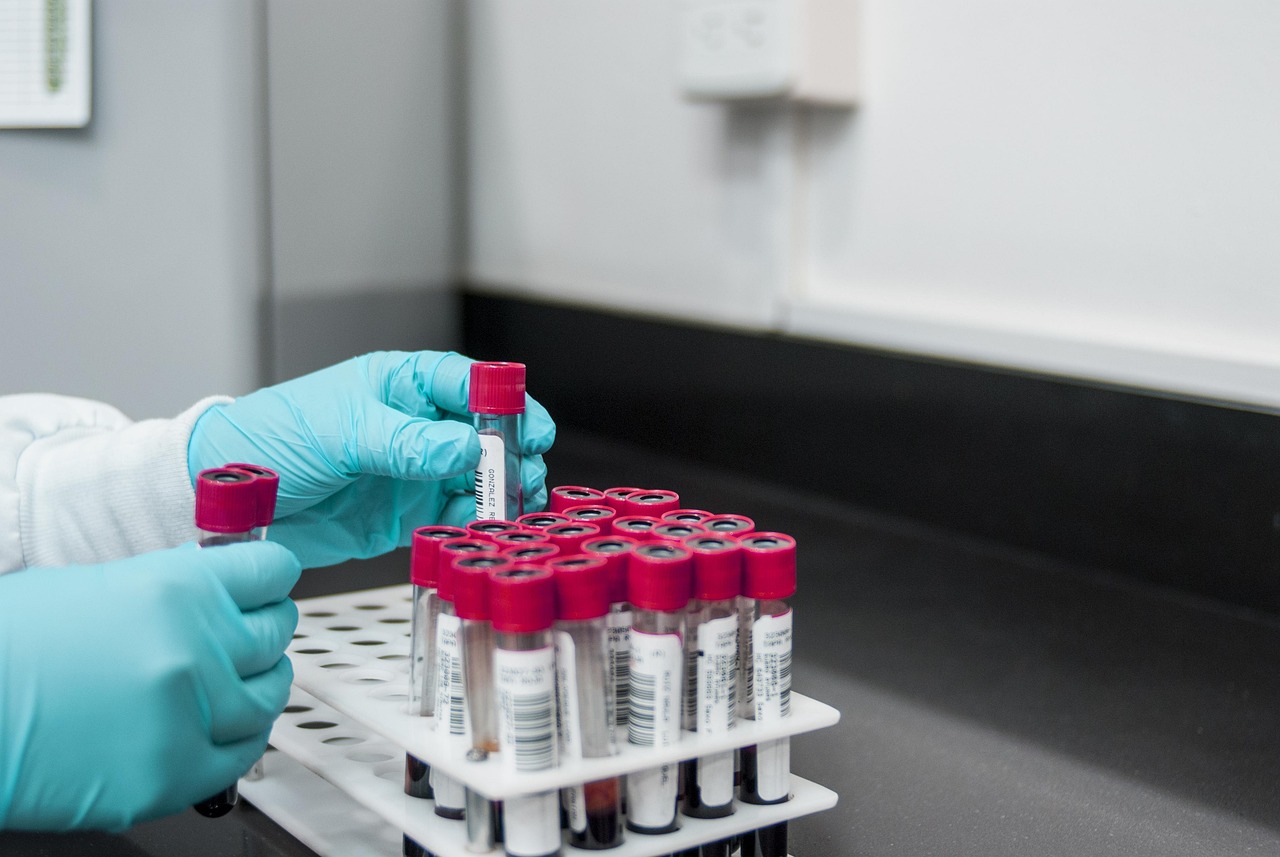 Gloved technician handling blood sample tubes in a laboratory for liquid biopsy testing.