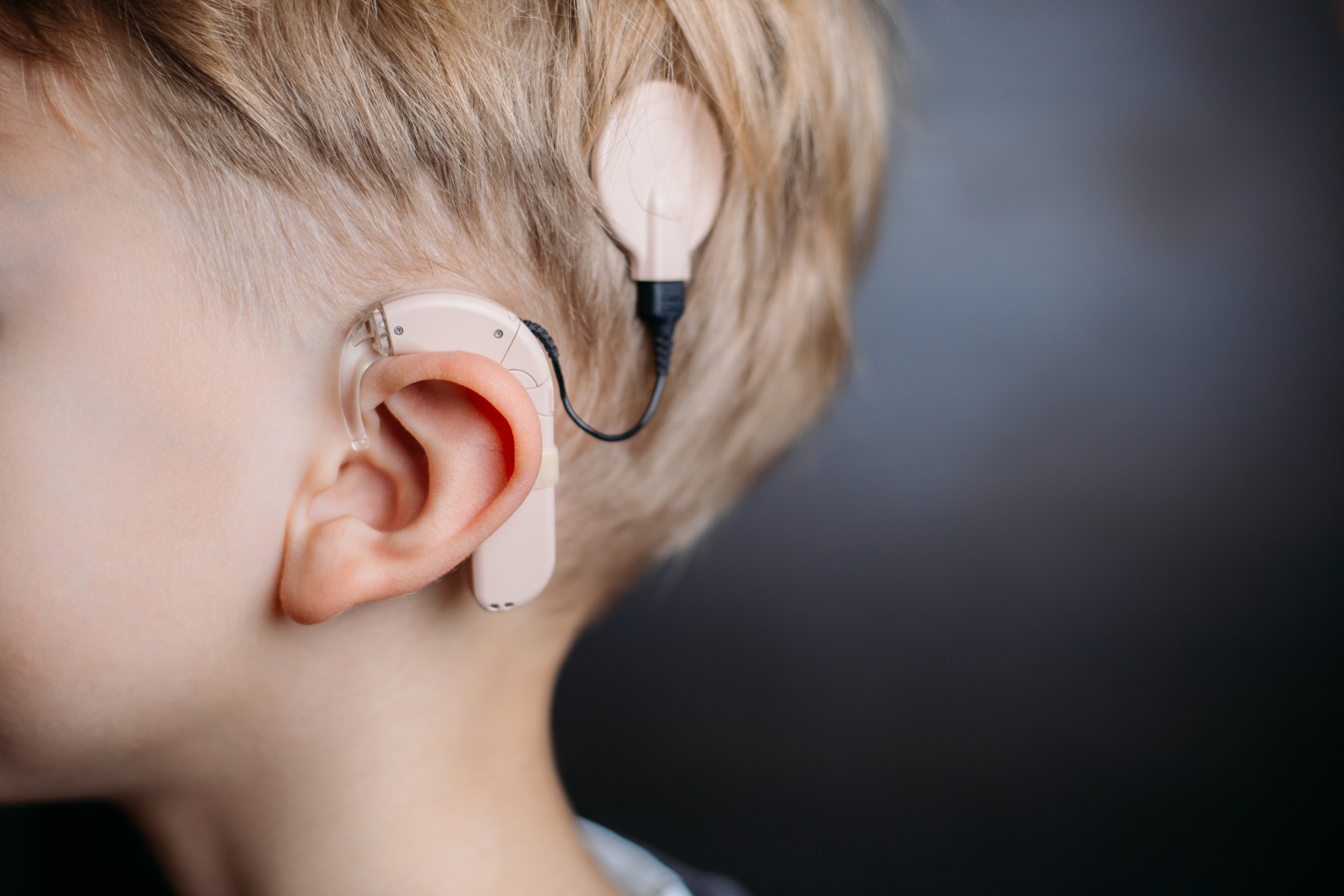 Child wearing a cochlear implant, highlighting hearing innovation supported by Canadian charities in Manitoba